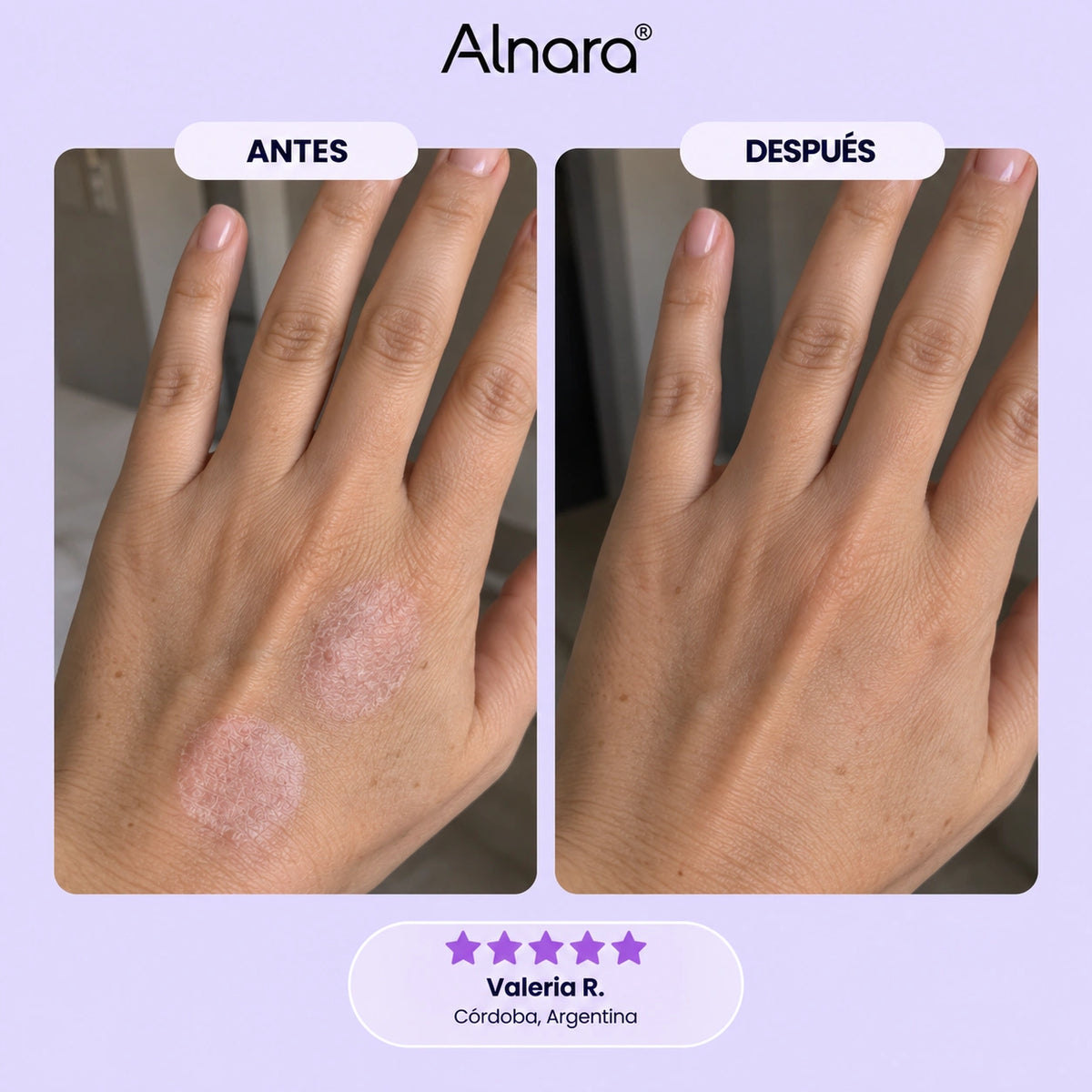 Tiras de Silicona de Grado Medico