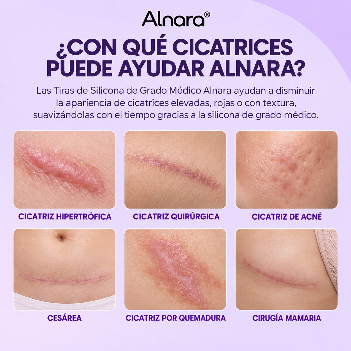 Tiras de Silicona de Grado Medico