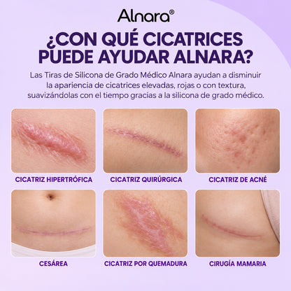 Tiras de Silicona de Grado Medico